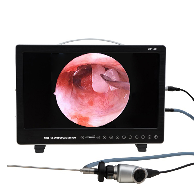 Laptop Accessories All In One - Sistem Kamera Endoskopi 22 Inci 80W